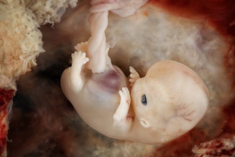 La placenta donde creciste te pudo cambiar la vida