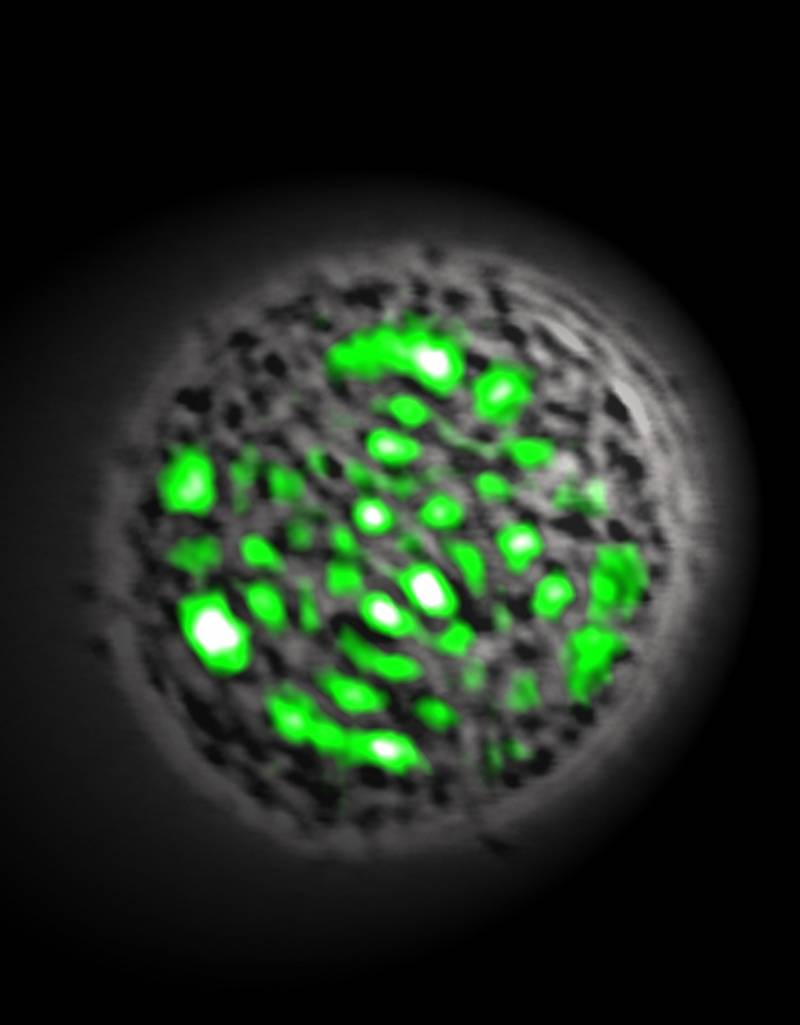 Crean el primer láser celular con proteínas fluorescentes