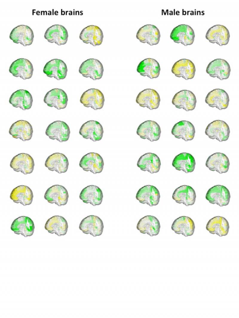 El cerebro no entiende de sexos