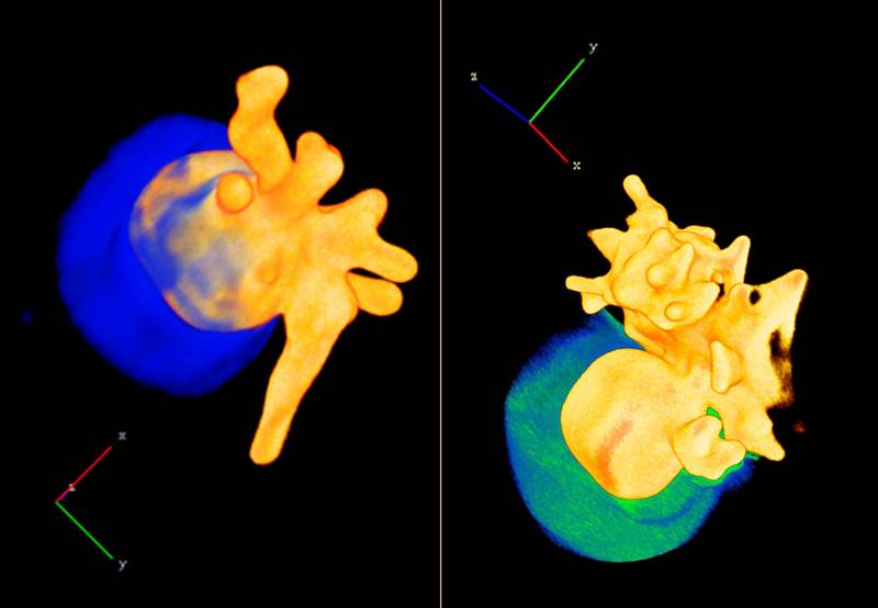 Nanopartículas de oro y óxido