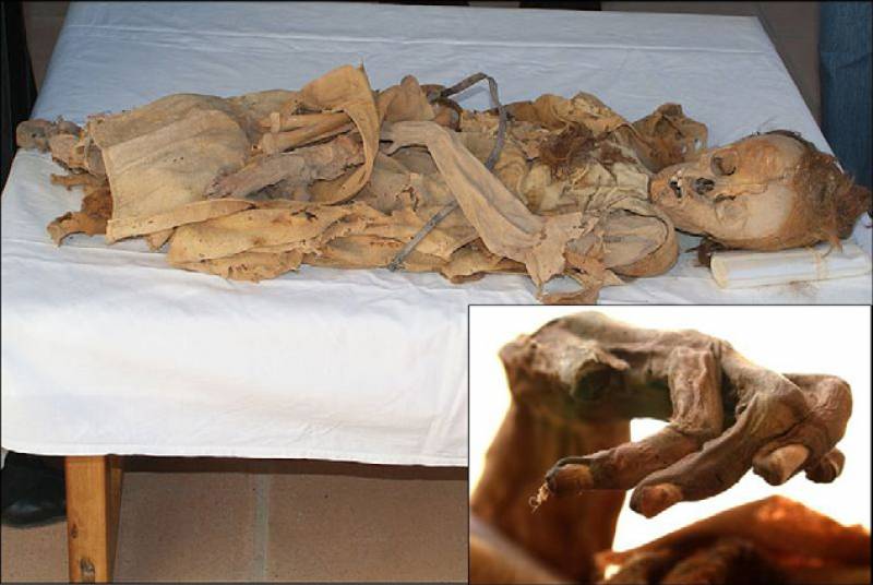 Aspecto general de la momia de Sancho de Castilla, vestida con un hábito de lino y un cíngulo de cuero. Los huesos de las piernas se encuentran desarticulados en el regazo. La hemicara izquierda estaba muy bien conservada, reconociéndose incluso el párpado y las pestañas. También conservaba gran parte del cuero cabelludo. Imagen: UCM.
