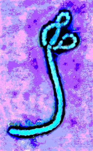 Micrografía del virus del ébola tomada en 1976. / F. A. Murphy-University of Texas Medical Branch