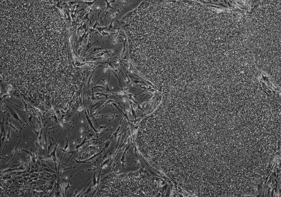 Imagen de células madre pluripotentes inducidas humanas creciendo en los fibrobastos embrionarios de un ratón. / Sugimura