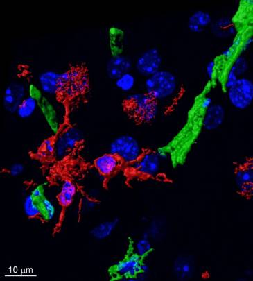Las células del sistema inmune (rojo) salen de los vasos cerebrales (verde) para infiltrarse en el cerebro de ratones con alzhéimer. El tratamiento a largo plazo con dabigatrán disminuye este proceso y la patología asociada. / CNIC