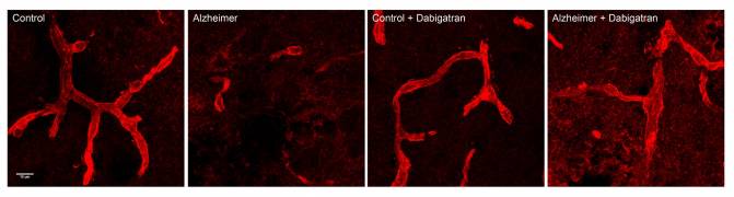 Los vasos cerebrales (rojo) están dañados en los ratones con alzhéimer, pero el tratamiento anticoagulante con dabigatrán previene dicho daño vascular. / CNIC