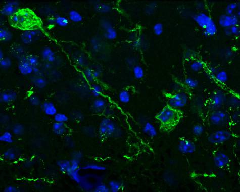 Microfotografía de la amígdala cerebral. En verde se señalan las neuronas Tac2, implicadas en la memoria del miedo. En azul se observa el núcleo de las neuronas de la amígdala. / UAB