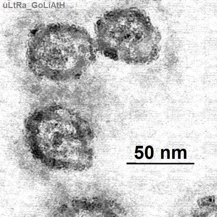 Una variación genética podría mejorar el tratamiento para la hepatitis C
