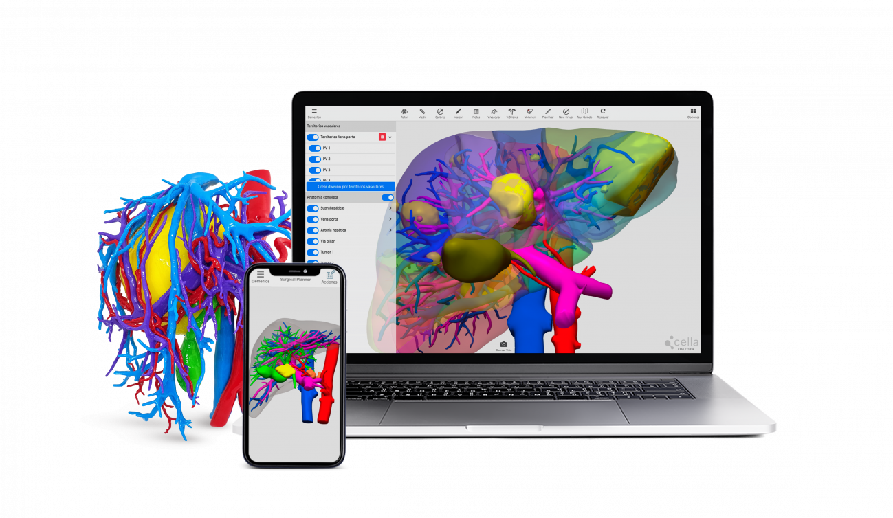 Los modelos 3D de órganos se pueden visualizar y usar sin descargar ningún programa, desde cualquier navegador. / Cella Medical Solutions