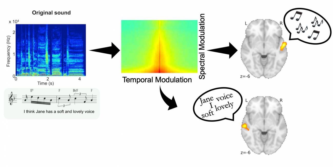 La canción original (abajo a la izquierda) y su espectrograma (arriba, en azul). La corteza auditiva de los lados derecho e izquierdo del cerebro decodifica la melodía y el habla, respectivamente, porque la melodía depende más de las modulaciones espectrales y el habla depende más de las modulaciones temporales. / Robert Zatorre