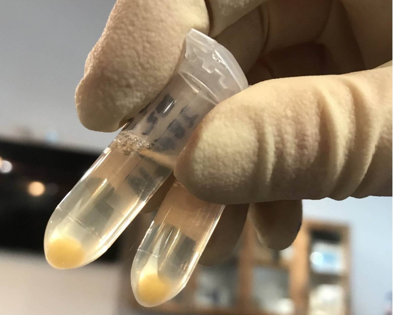 Vesículas extracelulares de origen neuronal extraídas de una muestra de sangre estándar
