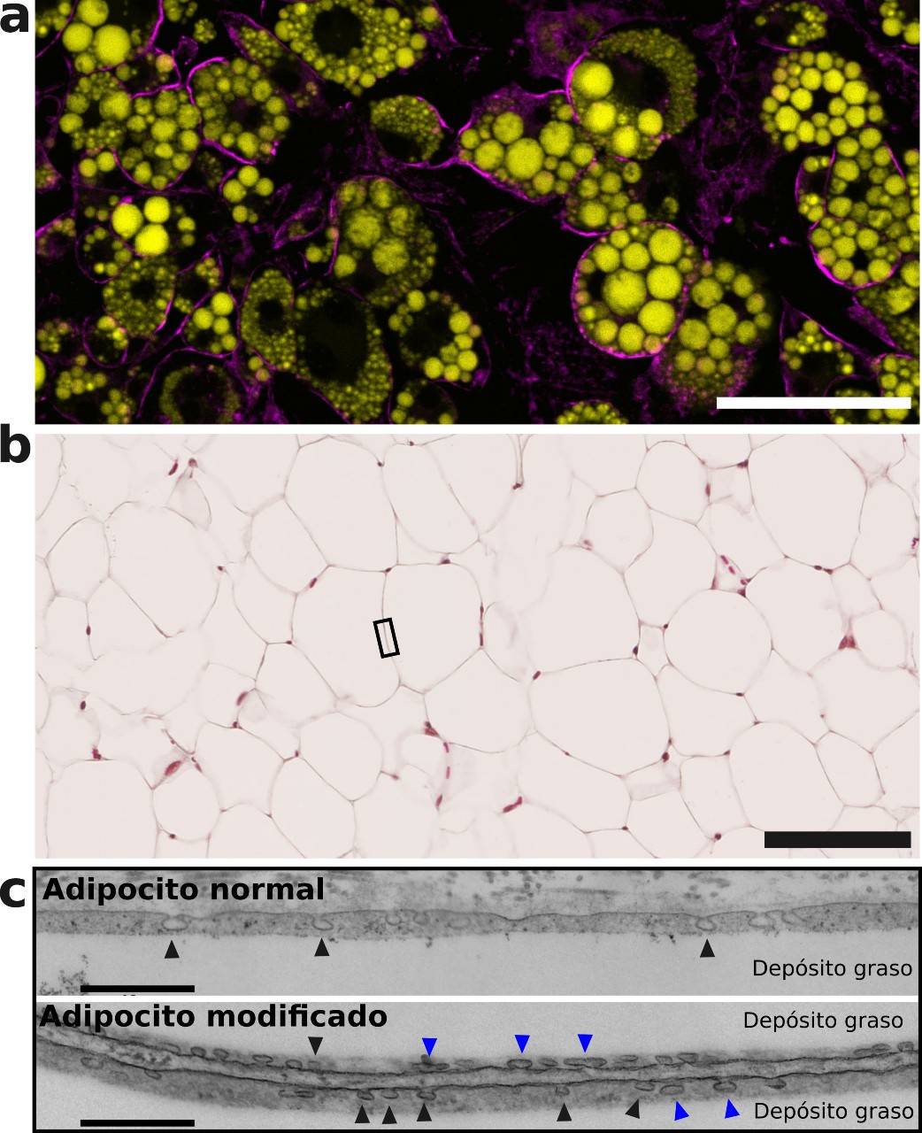 este nuevo trabajo destaca el papel de una proteína clave, Caveolina-1