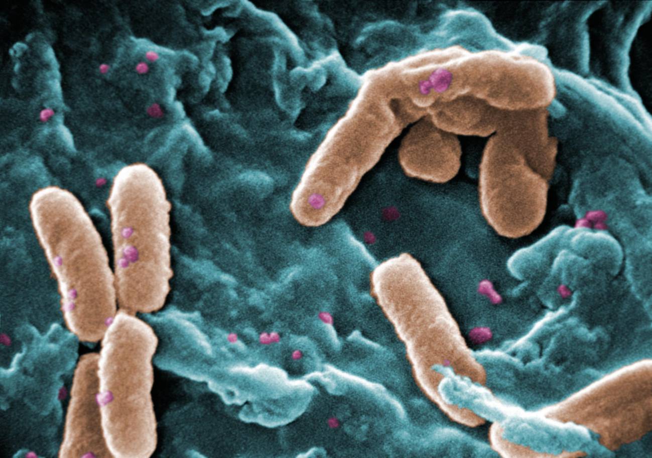Micrografía electrónica de barrido de la bacteria Pseudomonas aeruginosa. / Janice Haney Carr (CDC) / Wikipedia