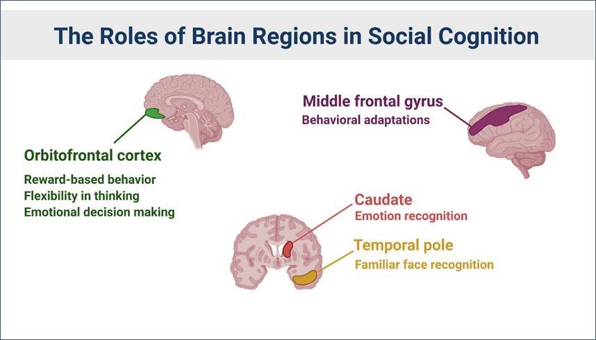 Diferentes regiones cerebrales y sus roles en la cognición social. / Sheila Davis/UPMC