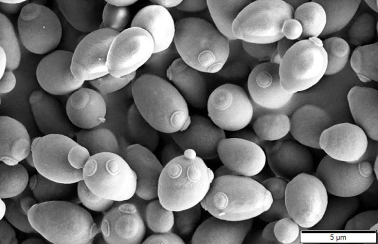 El otro microorganismo usado en el experimento, la levadura de cerveza (Saccharomyces cerevisiae), visto al microscopio electrónico de barrido. / Mogana Das Murtey and Patchamuthu Ramasamy