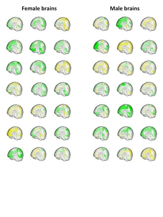 El cerebro no entiende de sexos