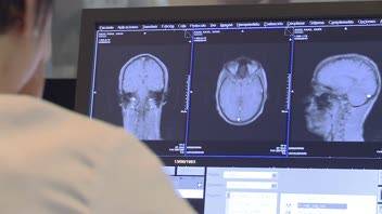 Los cambios estructurales y funcionales que provoca la cocaína en el cerebro favorecen la adicción