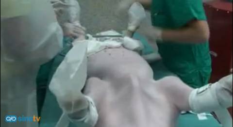 Terapia génica para la recuperación de corazones infartados