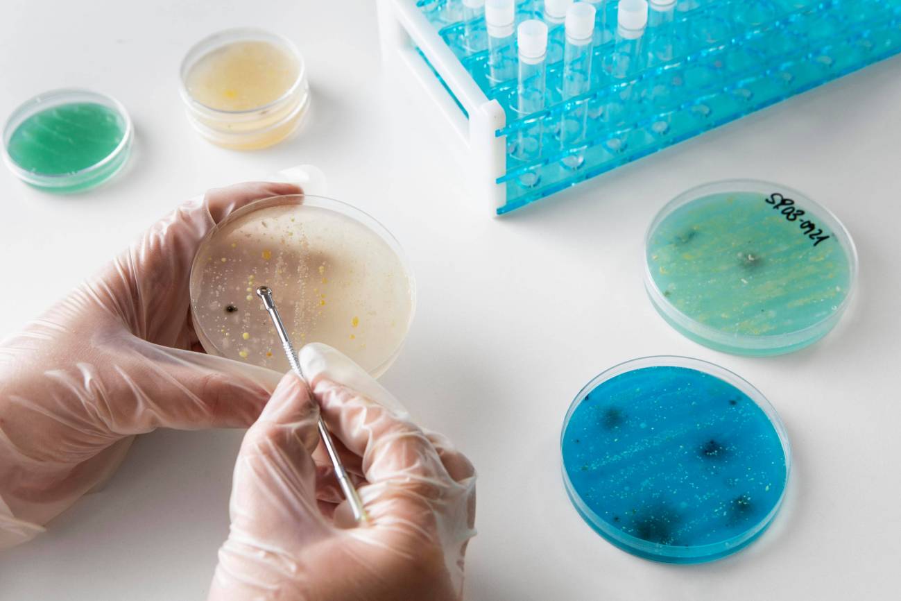 Asocian el aumento del cáncer de colon en jóvenes con una infección bacteriana en la infancia