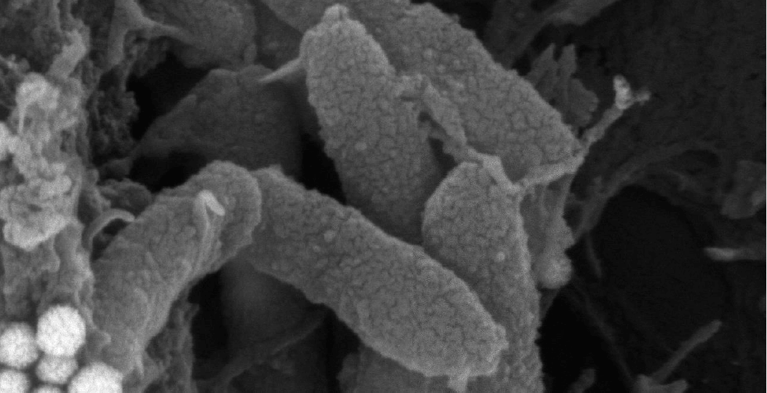 Descubren una estrategia terapéutica eficaz frente a bacterias resistentes