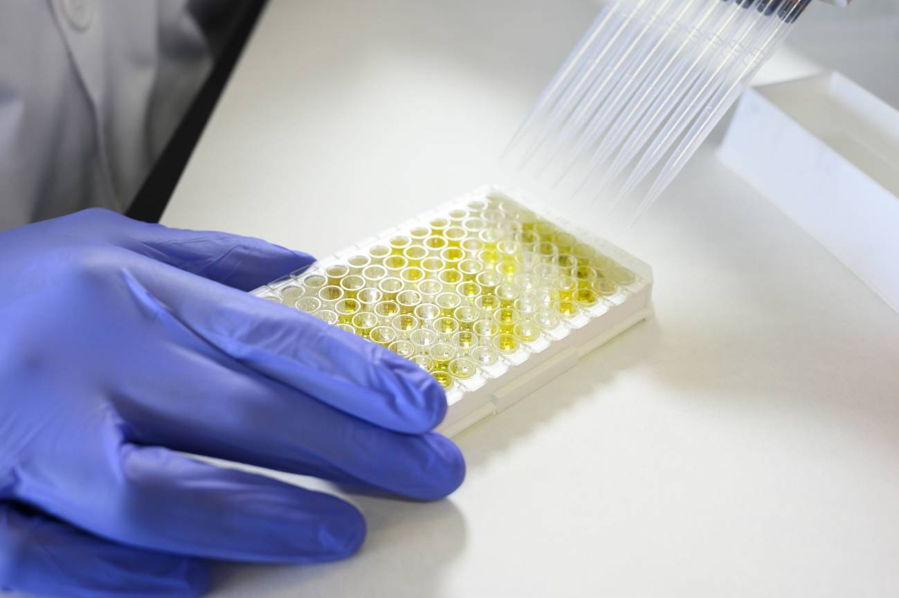 El CSIC firma una licencia para que sus test de anticuerpos de covid-19 lleguen a los países necesitados