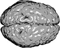 El daño en la parte frontal del cerebro afecta a nuestra habilidad para responder rápidamente ante un estímulo 