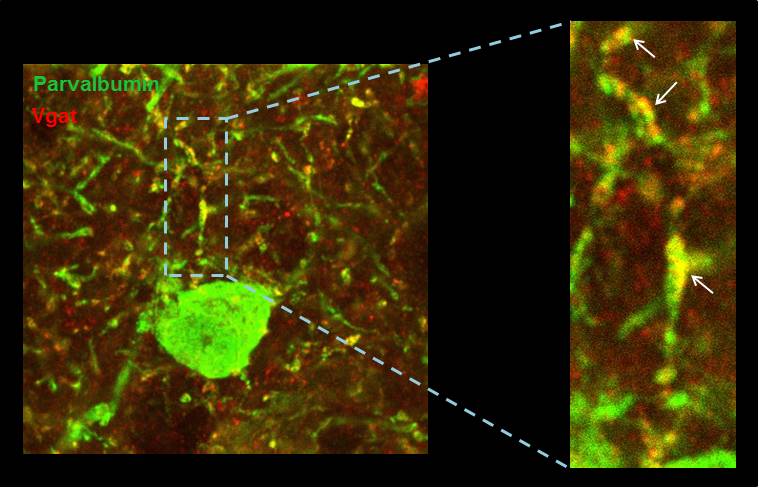 El ritmo de las ondas en la corteza cerebral, clave para el síndrome de Down