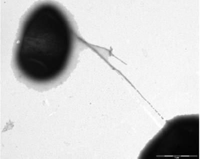 Hallan la clave del éxito de algunas de las bacterias más virulentas
