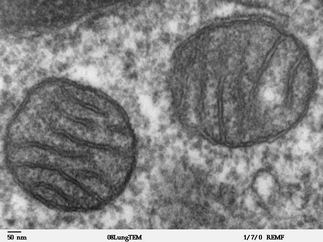 La producción defectuosa de energía en las células causa enfermedades neurodegenerativas 