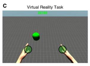 Los pacientes con ictus recuperan el uso del brazo con la realidad virtual