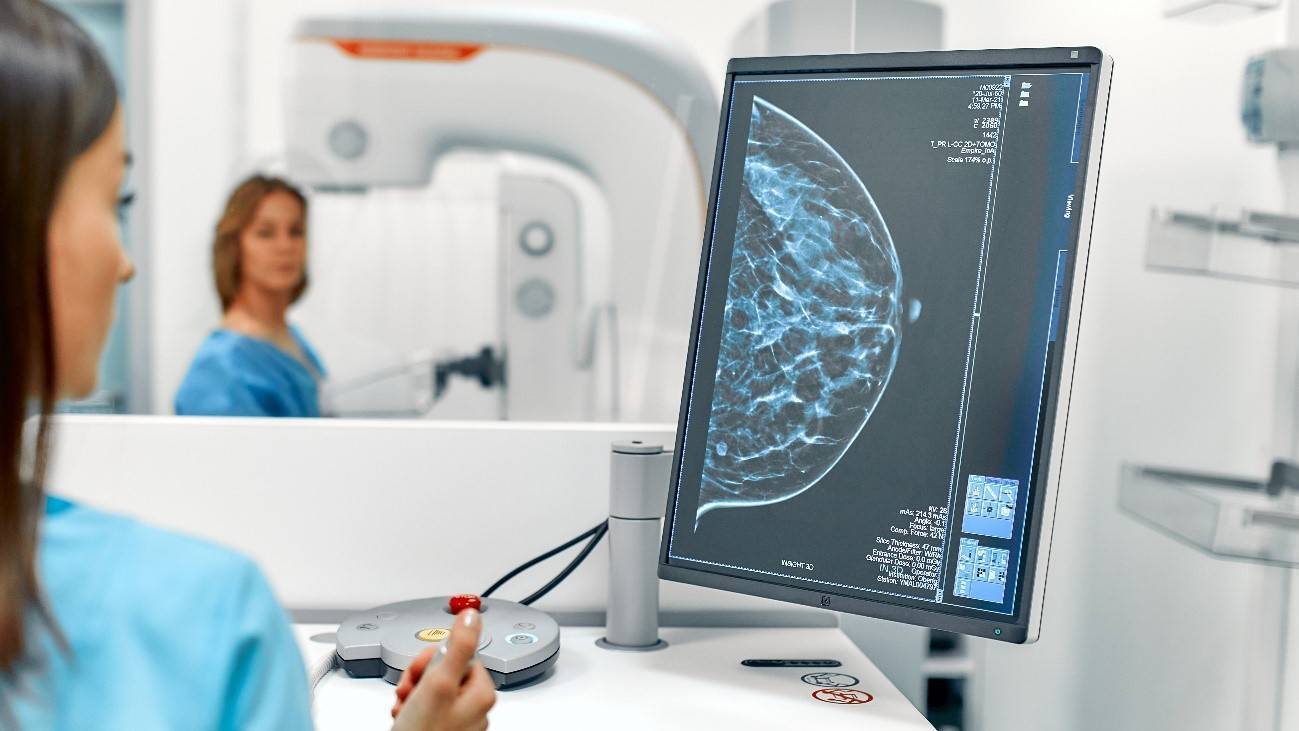 mamografía, cáncer de mama
