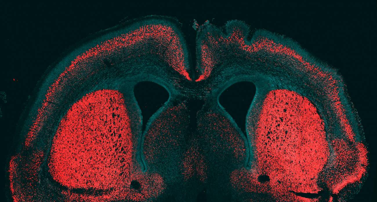 Un gen que llena el cerebro de surcos es único en el linaje humano 