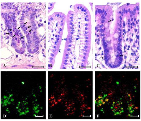 Un modelo de intestino permite probar alimentos funcionales
