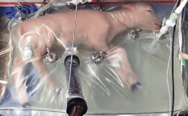 Un útero artificial permitirá reducir la mortalidad en bebés muy prematuros