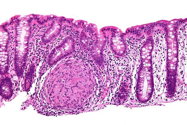 Cambios en los ciclos de luz alteran las defensas intestinales de los ratones 