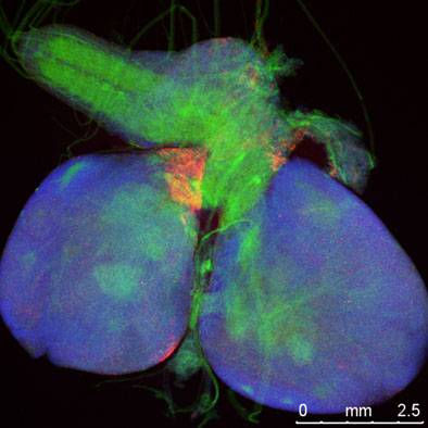Descubren un mecanismo supresor de tumores en la mosca ‘Drosophila’