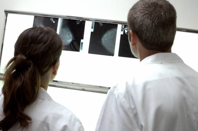 La metástasis requiere fármacos distintos a los usados contra el tumor de mama primario