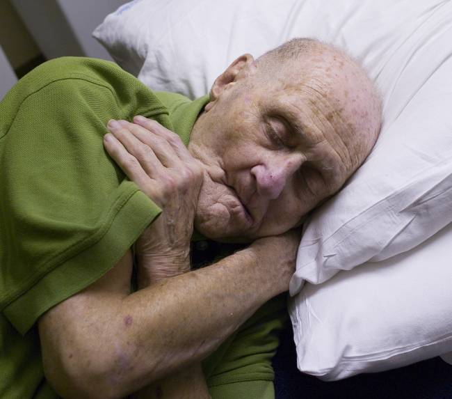 La vitamina B12 reduce el riesgo de Alzheimer
