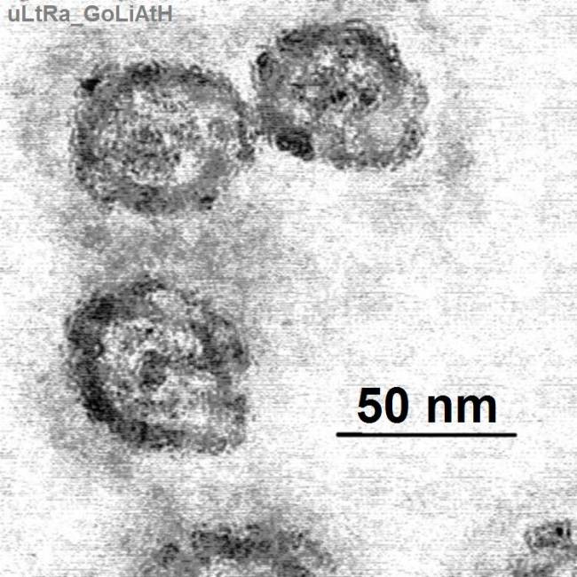 Una variación genética podría mejorar el tratamiento para la hepatitis C