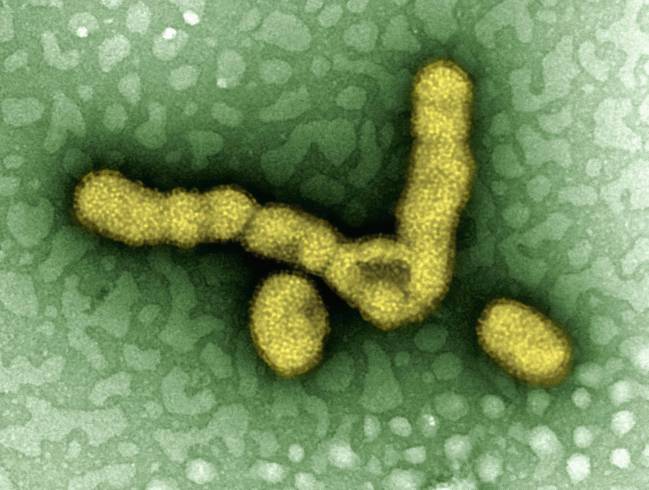 La gripe altera la microbiota pulmonar y potencia las infecciones secundarias