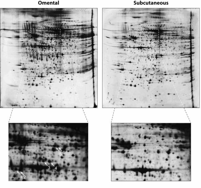 Analizan por primera vez la expresión de proteínas entre los dos tipos de grasa del cuerpo humano