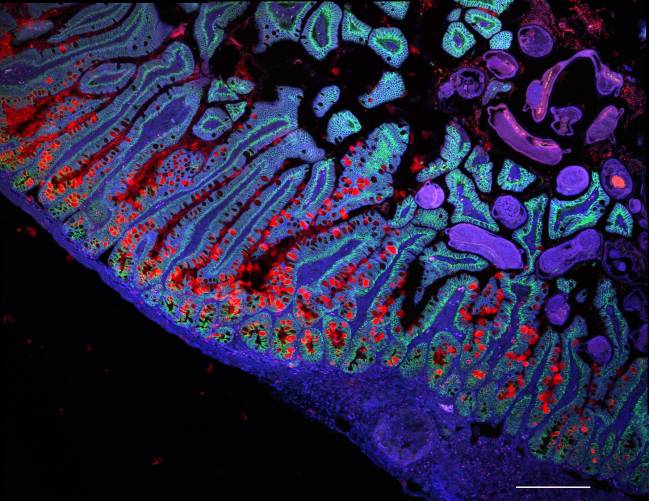 intestino delgado humano