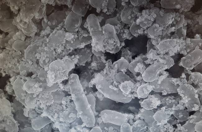 Bacterias de la aceituna ayudan a retirar metales tóxicos del intestino