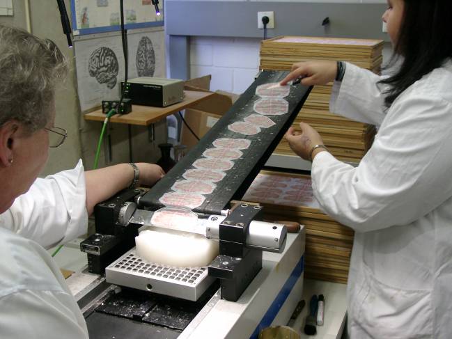 BigBrain recrea el cerebro humano en 3D con una precisión sin precedentes