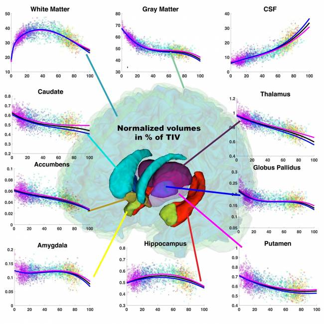 ¿Cómo cambia nuestro cerebro a lo largo de la vida? 