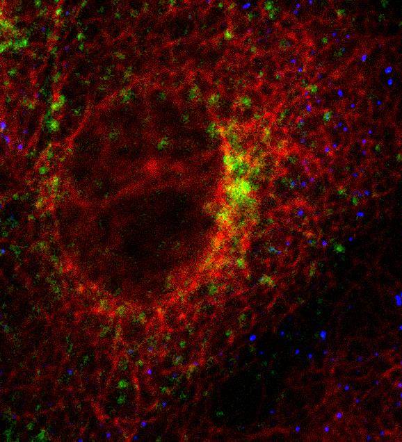 ¿Cómo entran los virus dentro de las células?