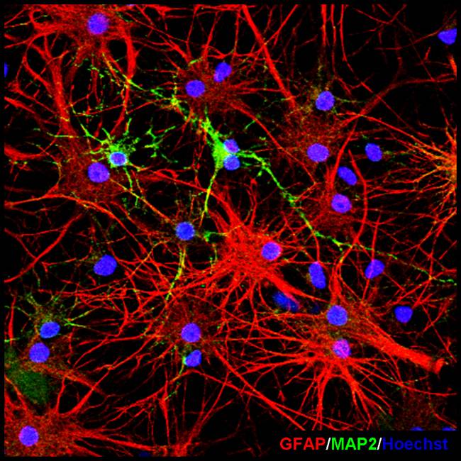 Crean un molde para nuevas piezas del puzzle neuronal