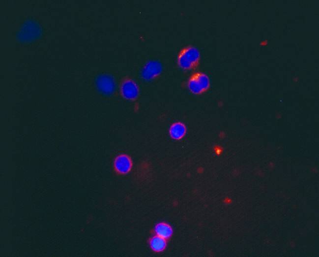 expresión de HCV-core