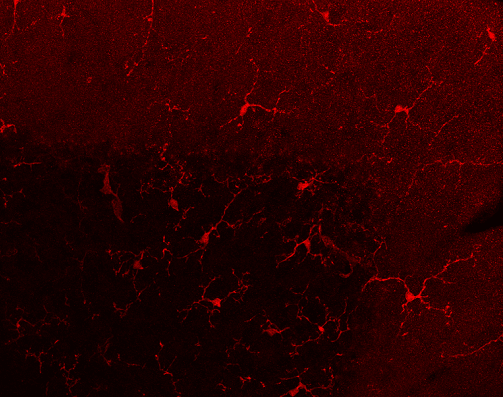 Imagen de microscopía que muestra células de la microglía en la corteza del cerebelo de ratón