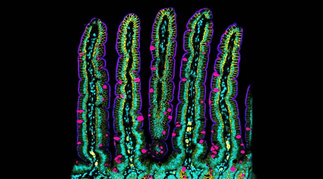 Descubren cómo se pliega y mueve la pared del intestino midiendo sus fuerzas
