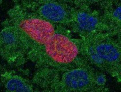 Descubren cómo una proteína del sistema inmune lucha contra el cáncer